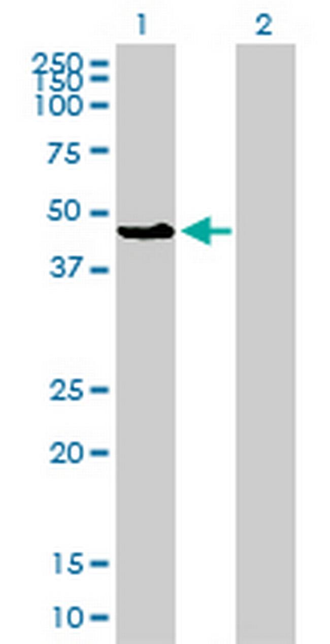 MAPK8 Antibody in Western Blot (WB)