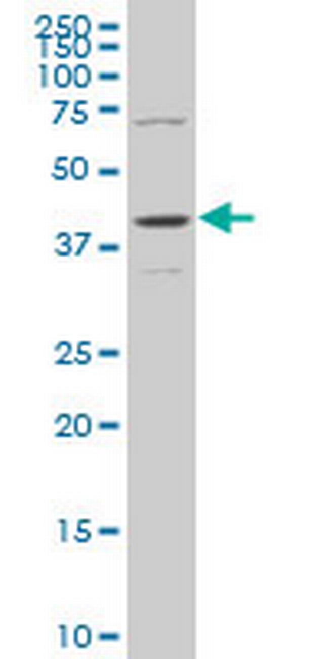 MAPK13 Antibody in Western Blot (WB)
