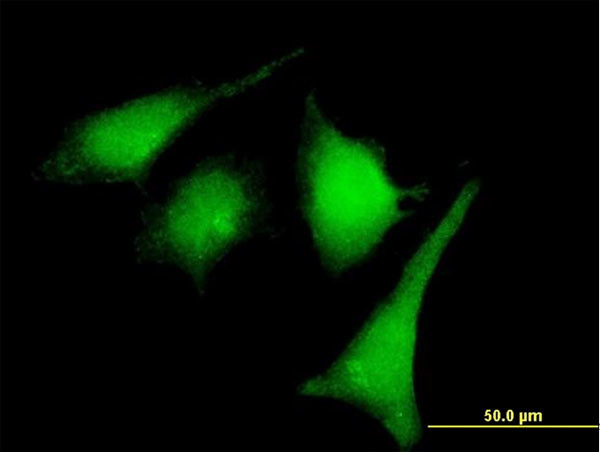 MAP2K2 Antibody in Immunocytochemistry (ICC/IF)