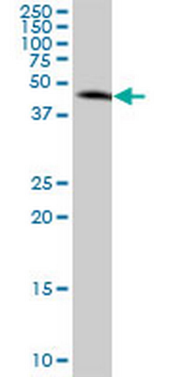 MAP2K3 Antibody in Western Blot (WB)
