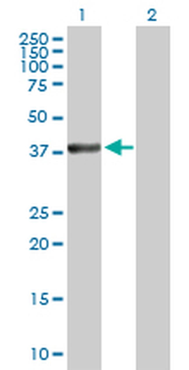 MAP2K3 Antibody in Western Blot (WB)