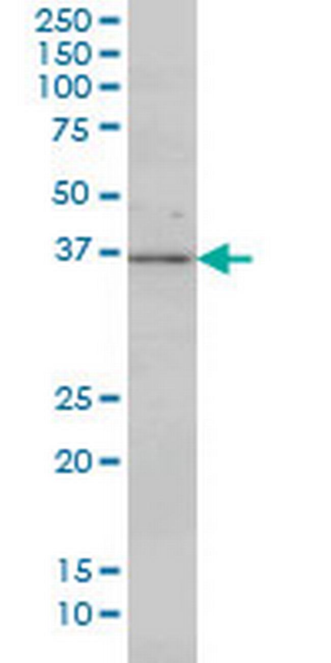MAP2K3 Antibody in Western Blot (WB)