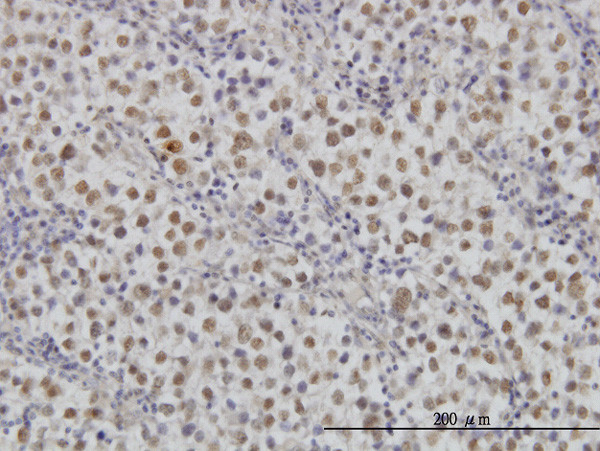 MAP2K3 Antibody in Immunohistochemistry (Paraffin) (IHC (P))