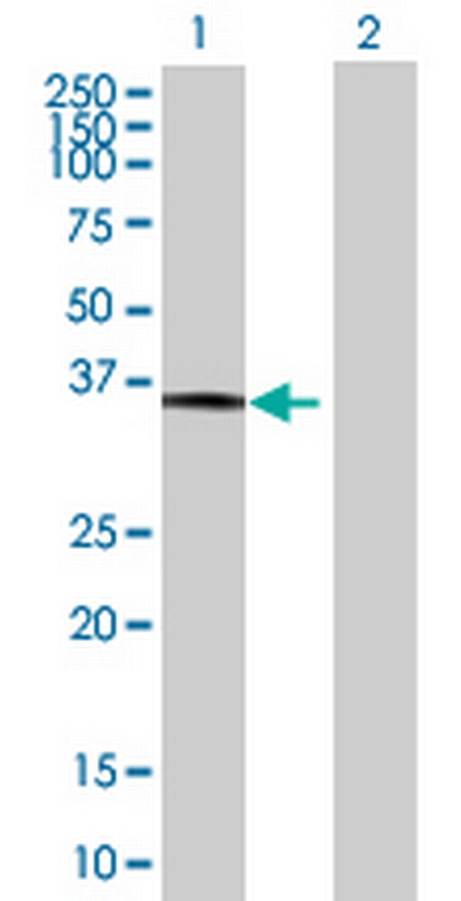 MAP2K6 Antibody in Western Blot (WB)
