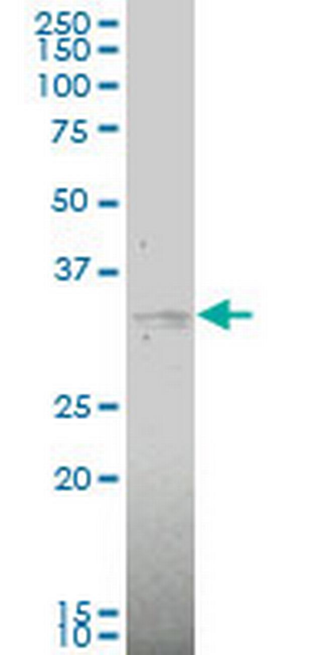MAP2K6 Antibody in Western Blot (WB)