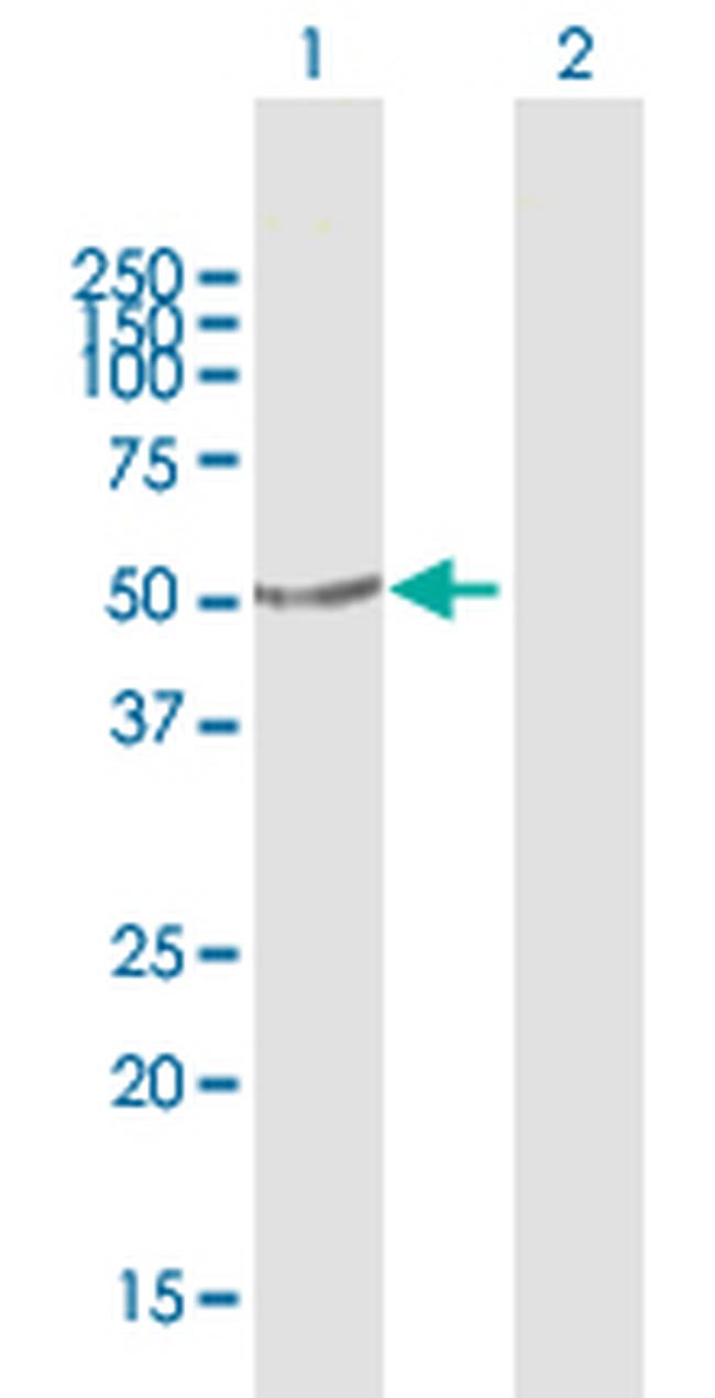 PRKX Antibody in Western Blot (WB)