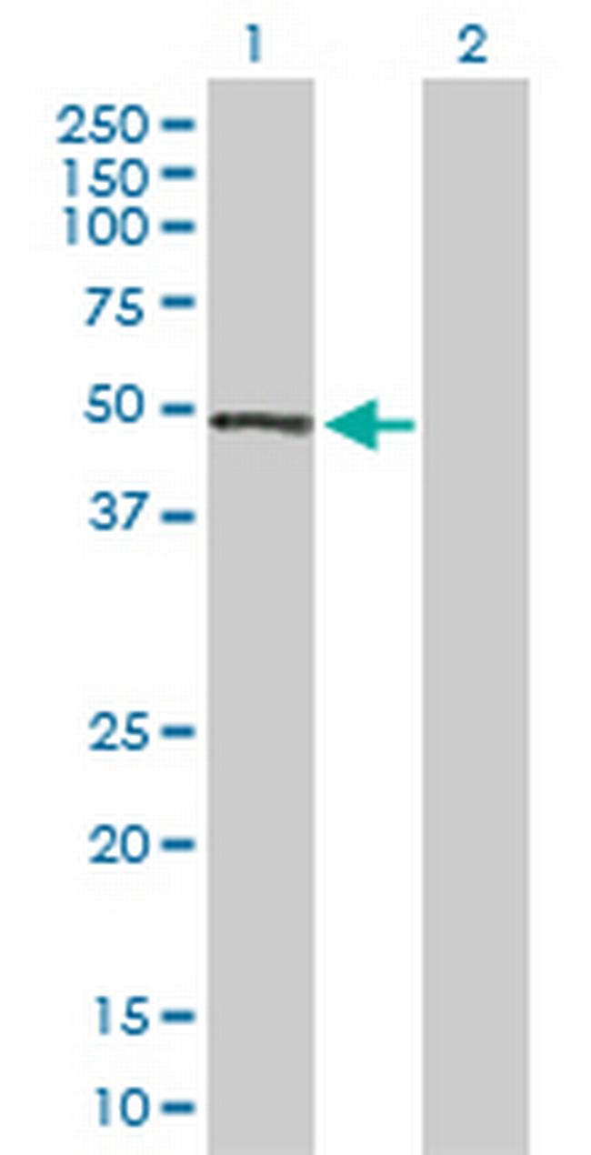PRKX Antibody in Western Blot (WB)