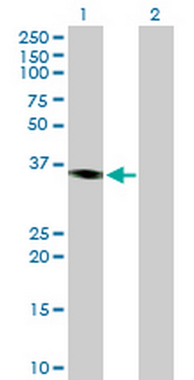 PRKY Antibody in Western Blot (WB)