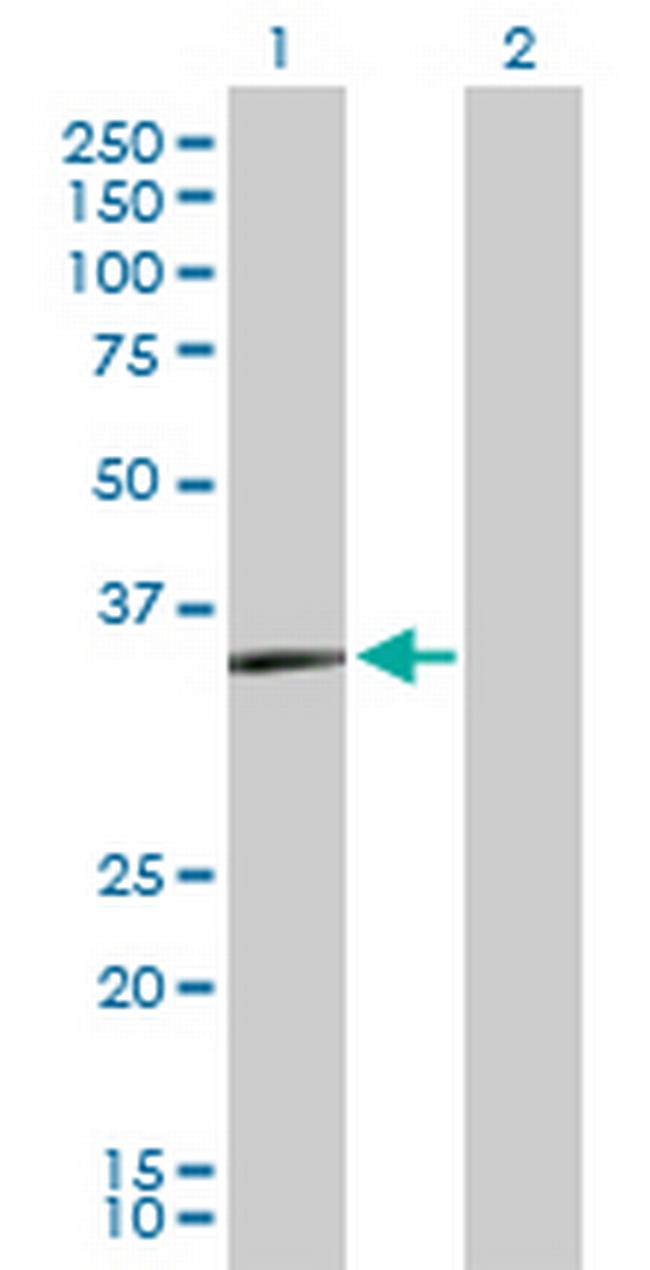 PRKY Antibody in Western Blot (WB)
