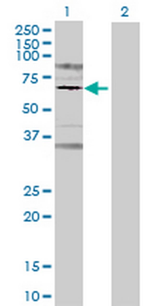 PRLR Antibody in Western Blot (WB)