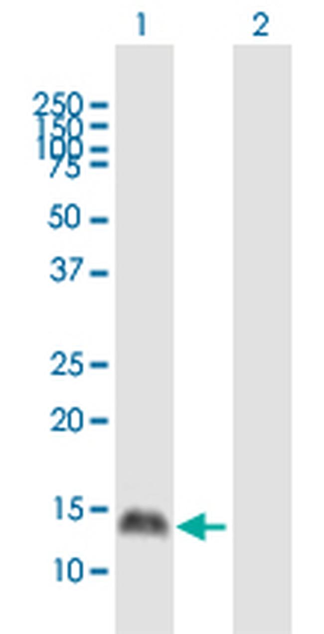 PRM1 Antibody in Western Blot (WB)