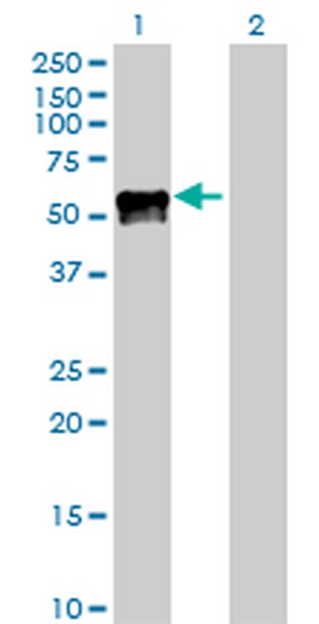 PROC Antibody in Western Blot (WB)