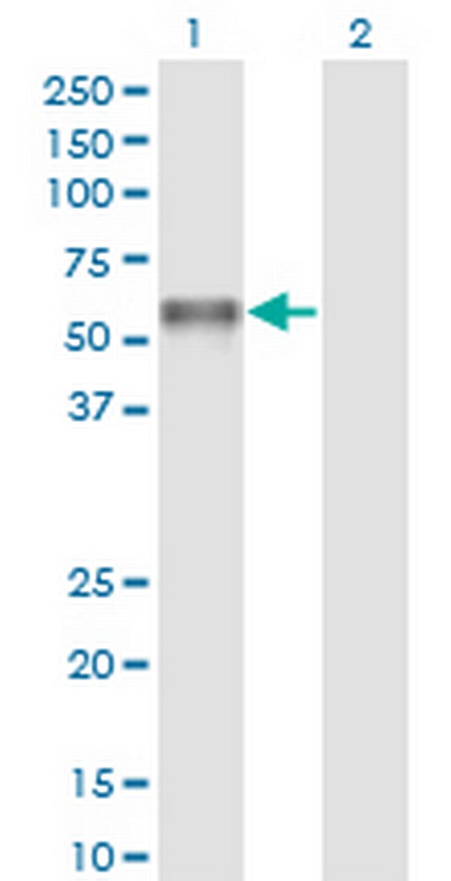 PROC Antibody in Western Blot (WB)