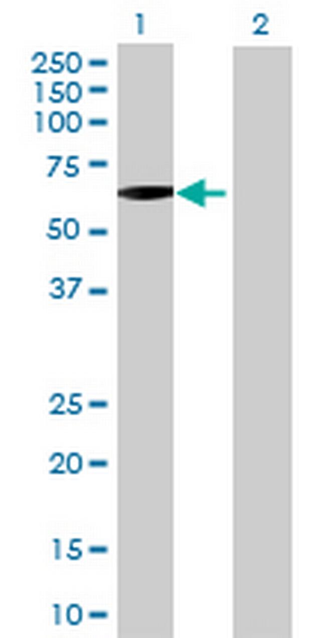 PRPH Antibody in Western Blot (WB)