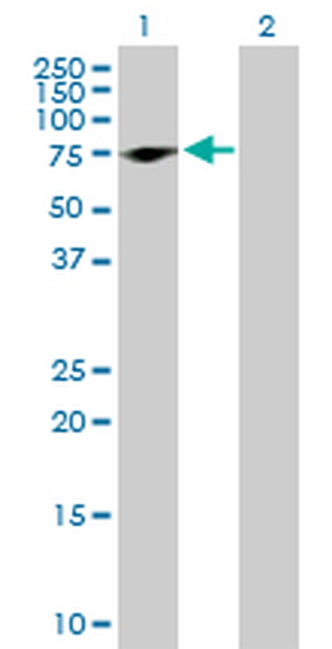 PRPH Antibody in Western Blot (WB)