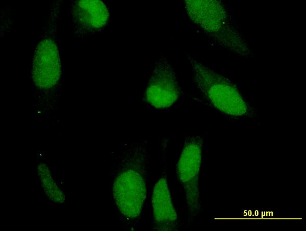 PRPH Antibody in Immunocytochemistry (ICC/IF)