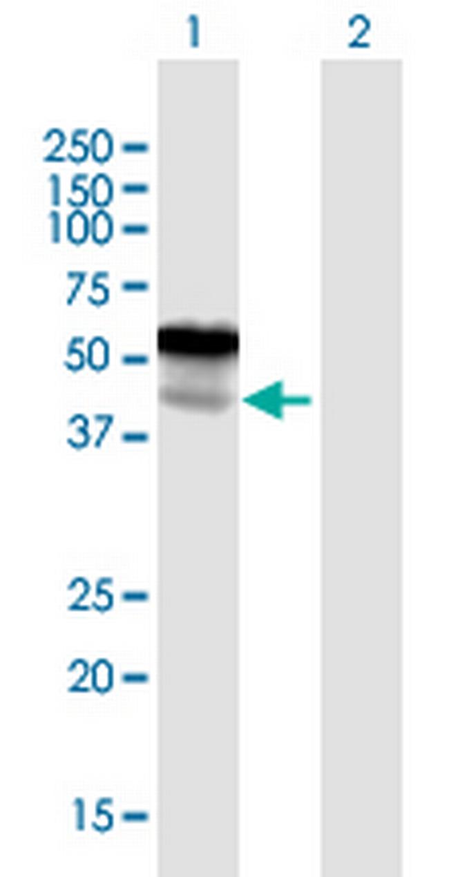 LGMN Antibody in Western Blot (WB)