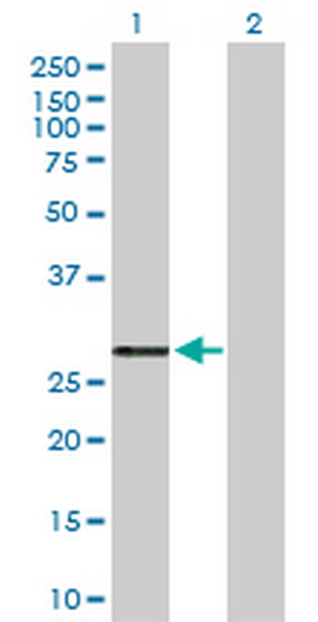 PRSS2 Antibody in Western Blot (WB)