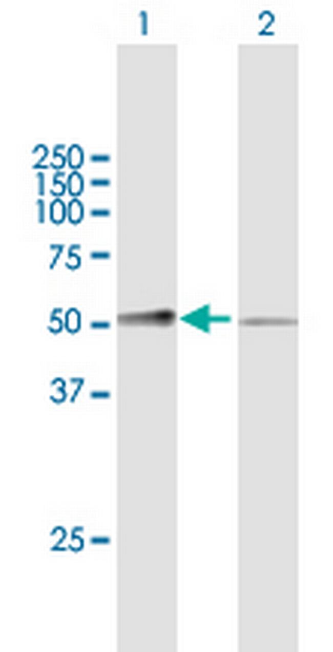 MASP1 Antibody in Western Blot (WB)
