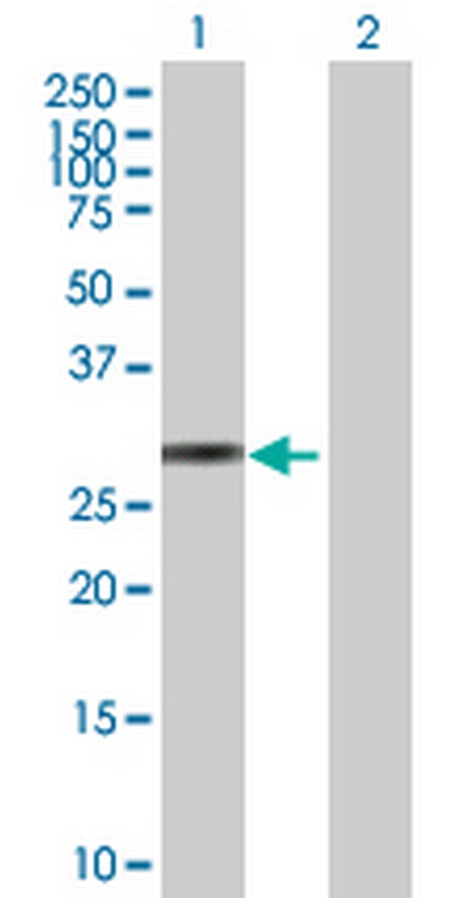 KLK10 Antibody in Western Blot (WB)