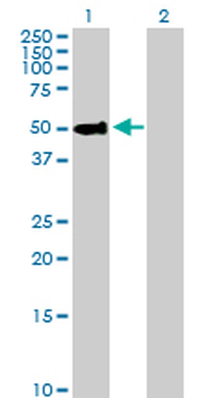 PSAP Antibody in Western Blot (WB)