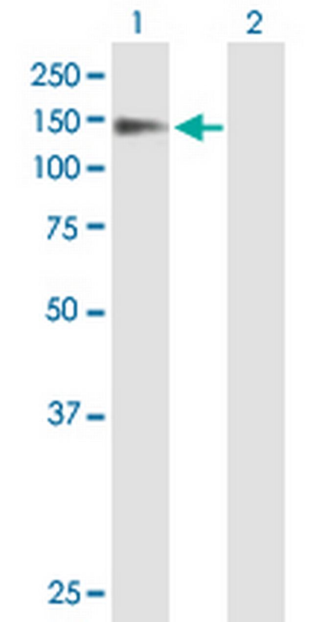 PSD Antibody in Western Blot (WB)