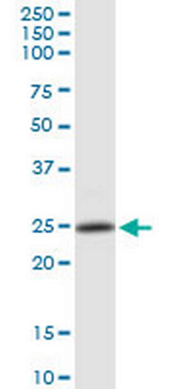 PSMB4 Antibody in Western Blot (WB)