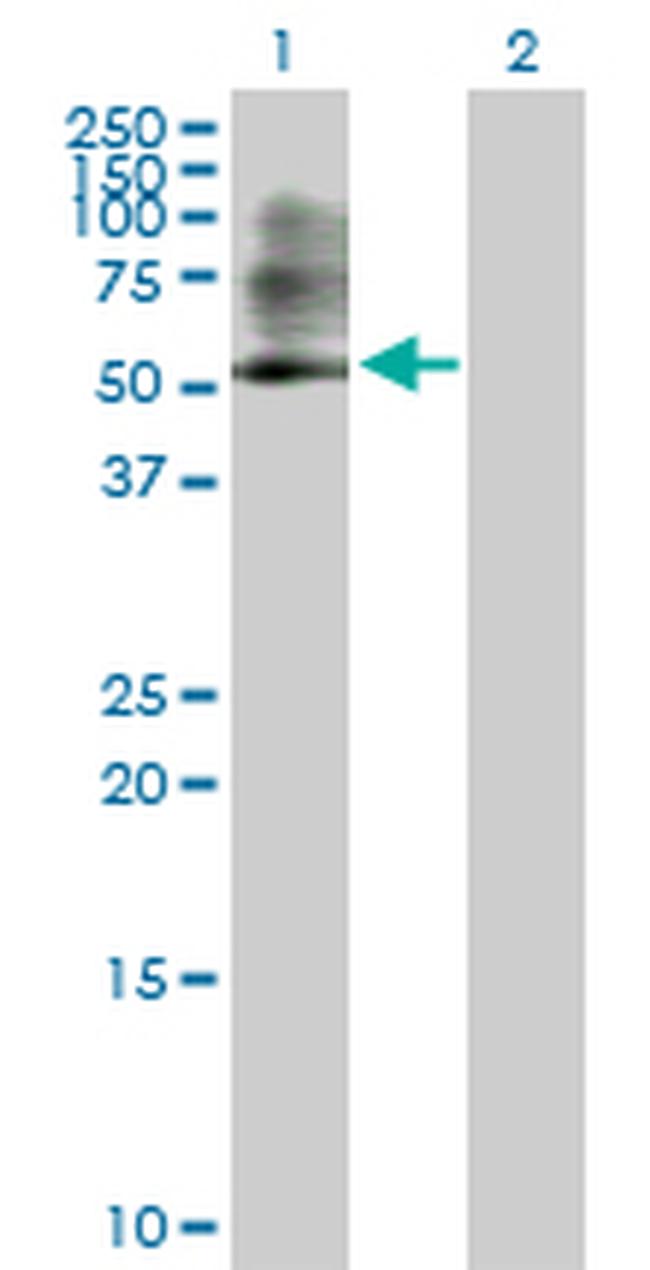 PSMC3 Antibody in Western Blot (WB)
