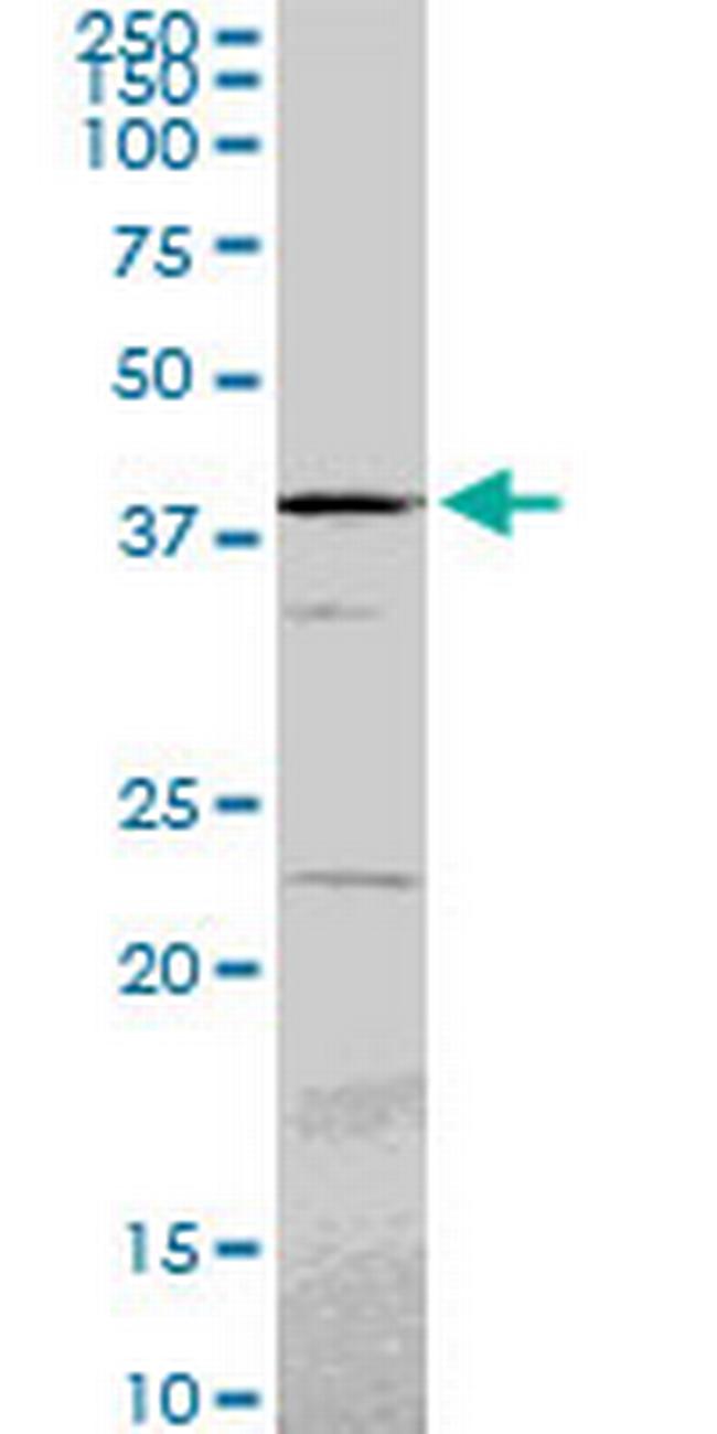 PSMC6 Antibody in Western Blot (WB)