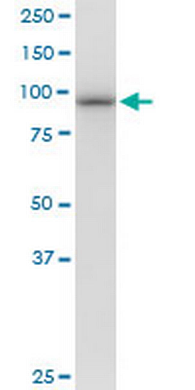 PSMD2 Antibody in Western Blot (WB)