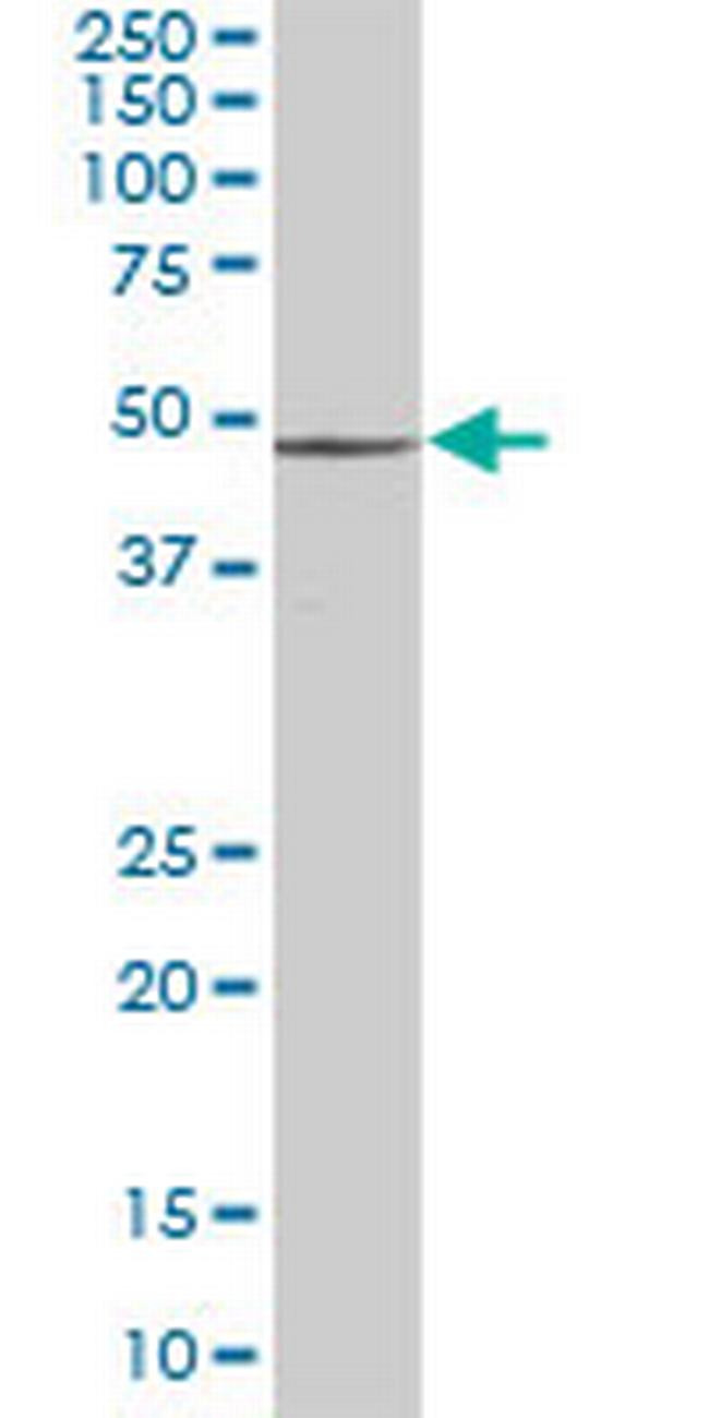 PSMD4 Antibody in Western Blot (WB)