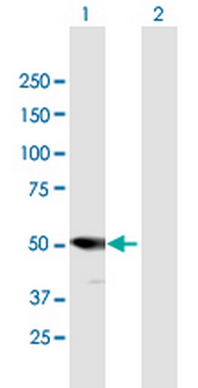PSMD5 Antibody in Western Blot (WB)