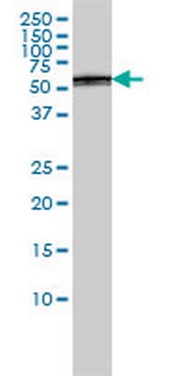 PSMD5 Antibody in Western Blot (WB)