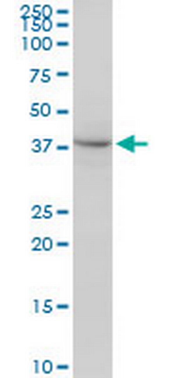 PSMD13 Antibody in Western Blot (WB)