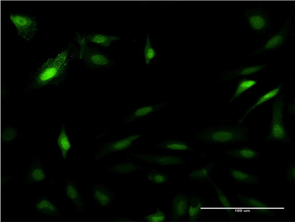 PSME2 Antibody in Immunocytochemistry (ICC/IF)