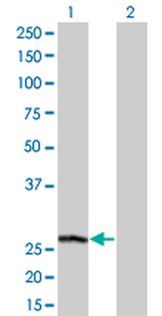 PSPH Antibody in Western Blot (WB)
