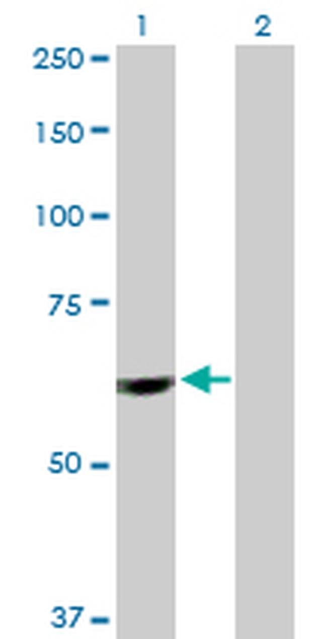 PTBP1 Antibody in Western Blot (WB)