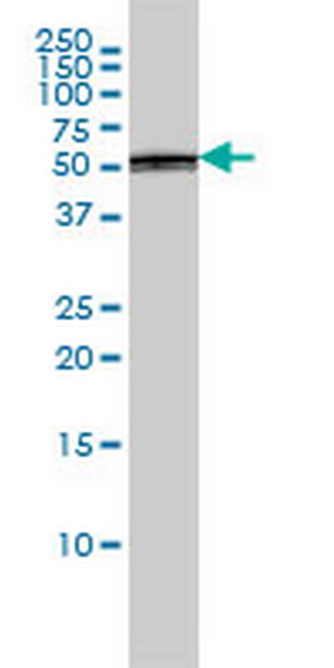 PTBP1 Antibody in Western Blot (WB)