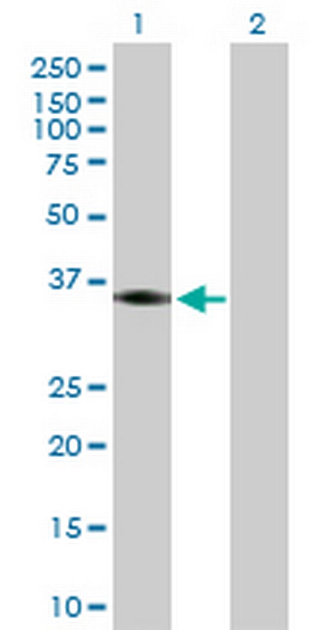 PTGER2 Antibody in Western Blot (WB)