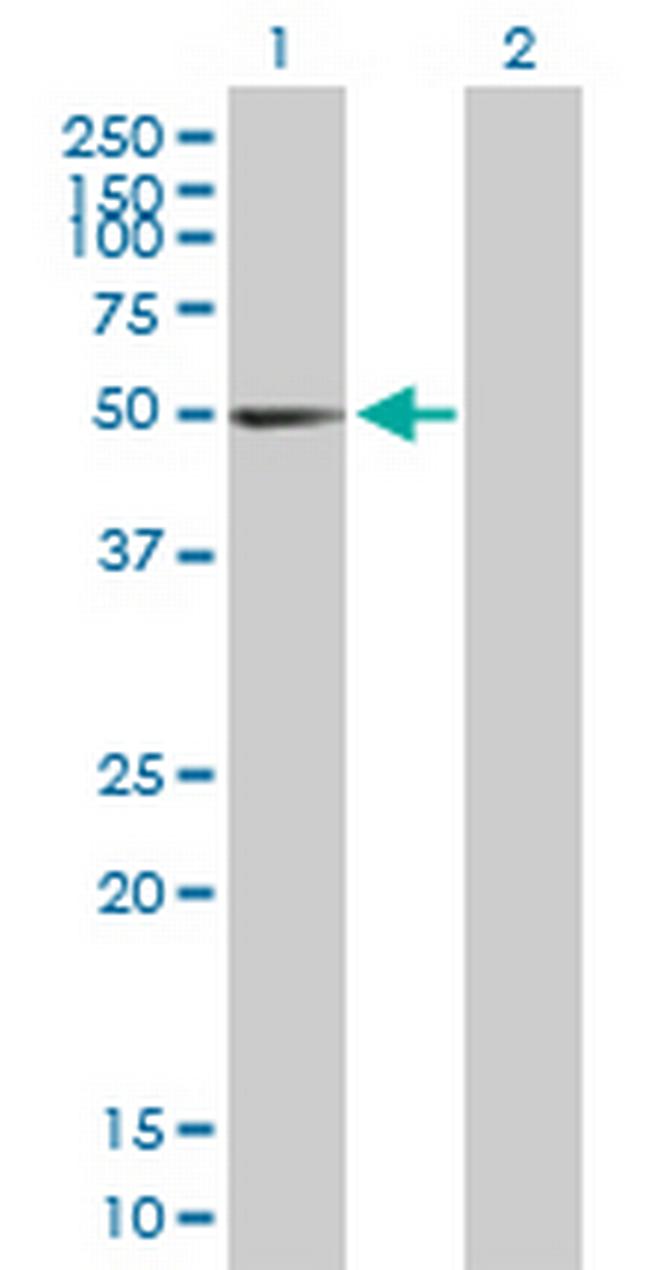 PTGIS Antibody in Western Blot (WB)