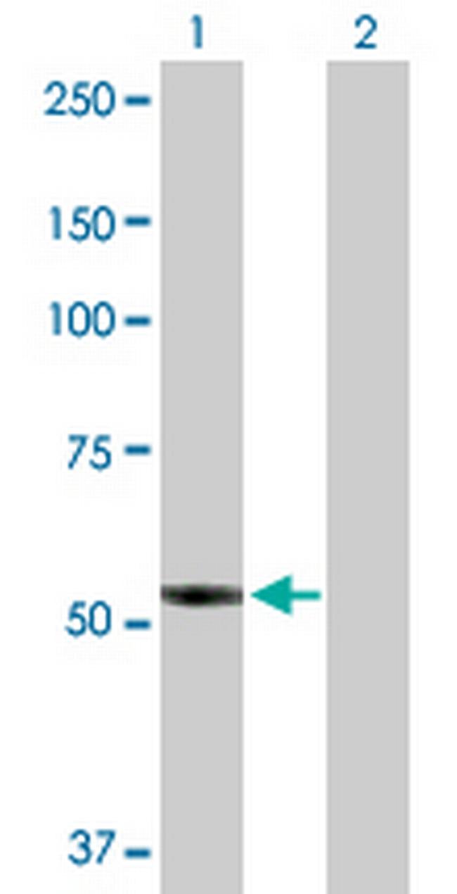 PTGIS Antibody in Western Blot (WB)