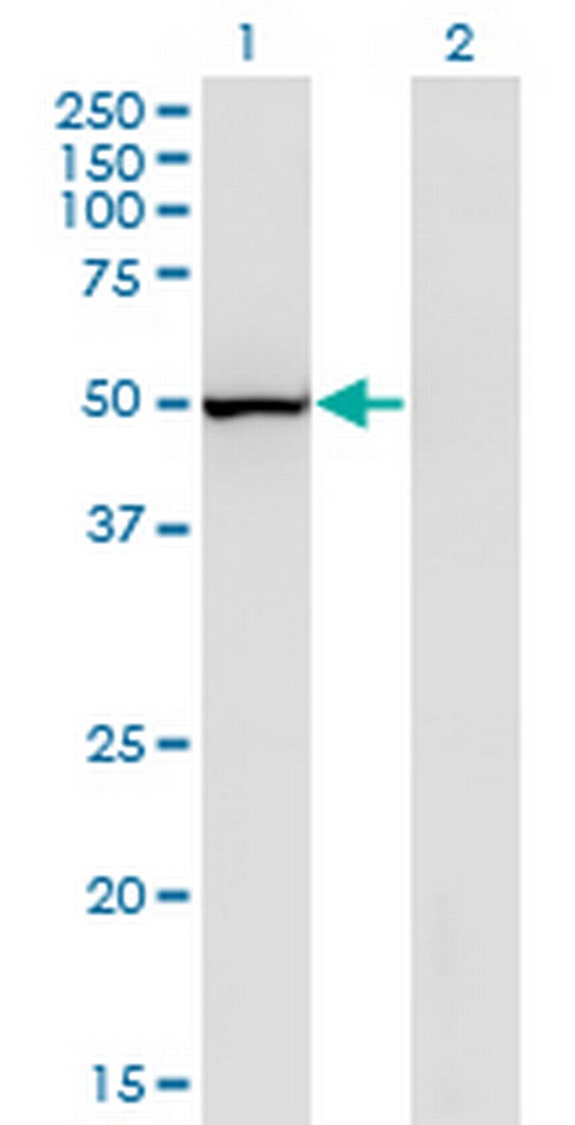 PTGIS Antibody in Western Blot (WB)