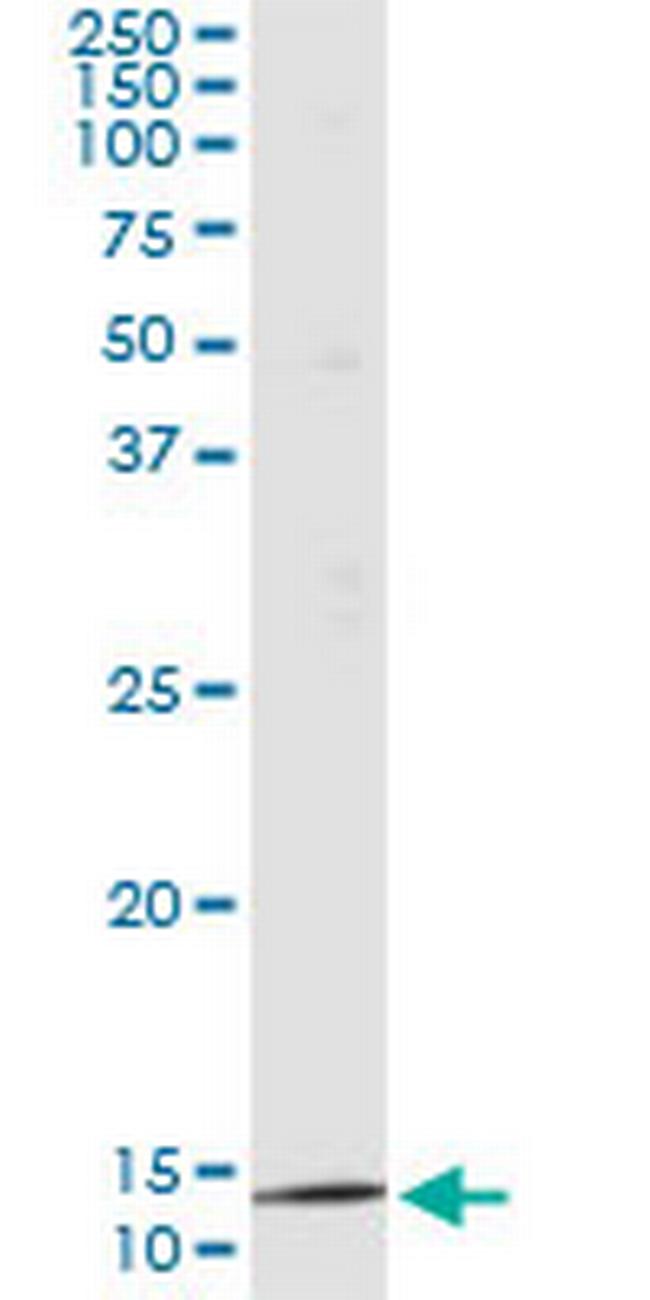 PTH Antibody in Immunoprecipitation (IP)