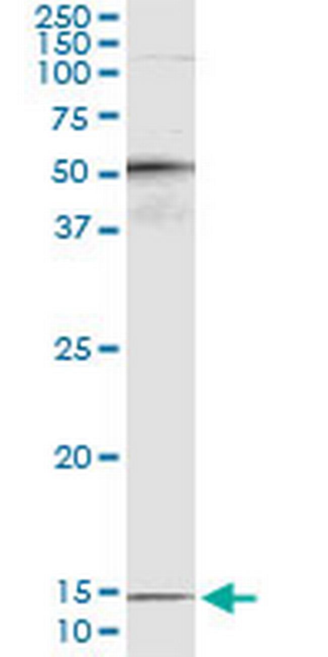PTH Antibody in Immunoprecipitation (IP)