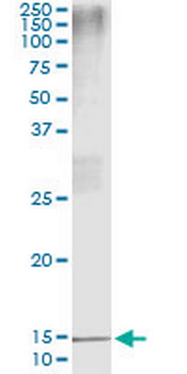 PTH Antibody in Immunoprecipitation (IP)