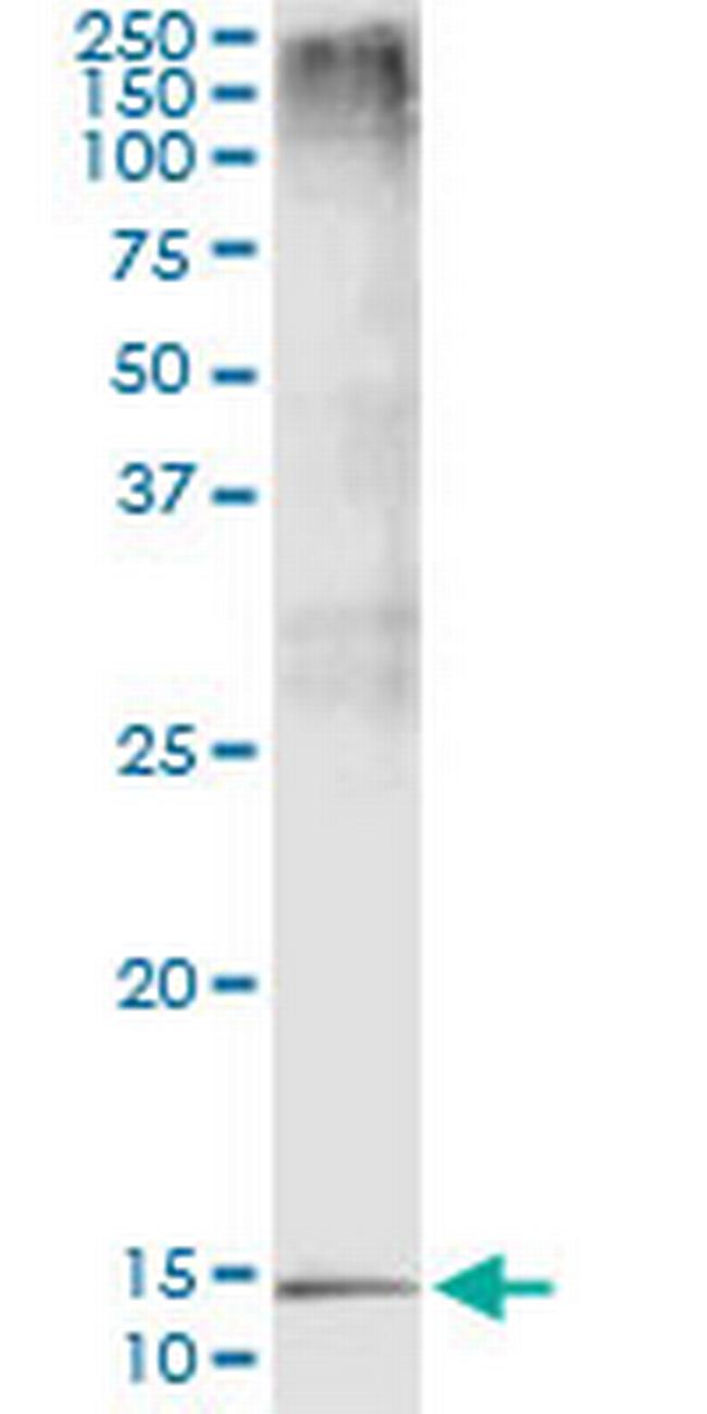 PTH Antibody in Immunoprecipitation (IP)