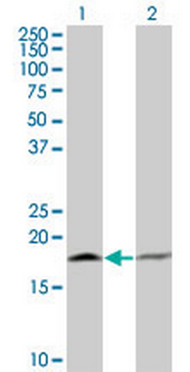 PTH Antibody in Western Blot (WB)