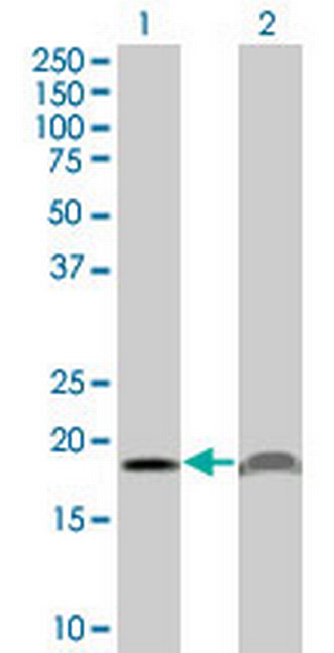 PTH Antibody in Western Blot (WB)