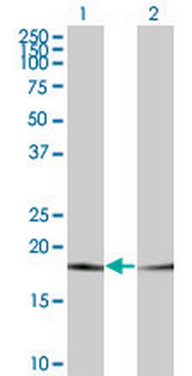 PTH Antibody in Western Blot (WB)