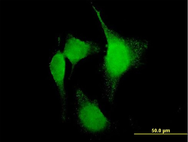 PTGS2 Antibody in Immunocytochemistry (ICC/IF)